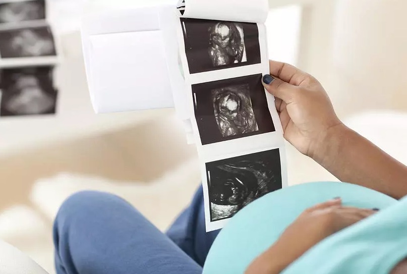 Les visites médicales pour les grossesses dans le cadre de la polygamie sont souvent drôles